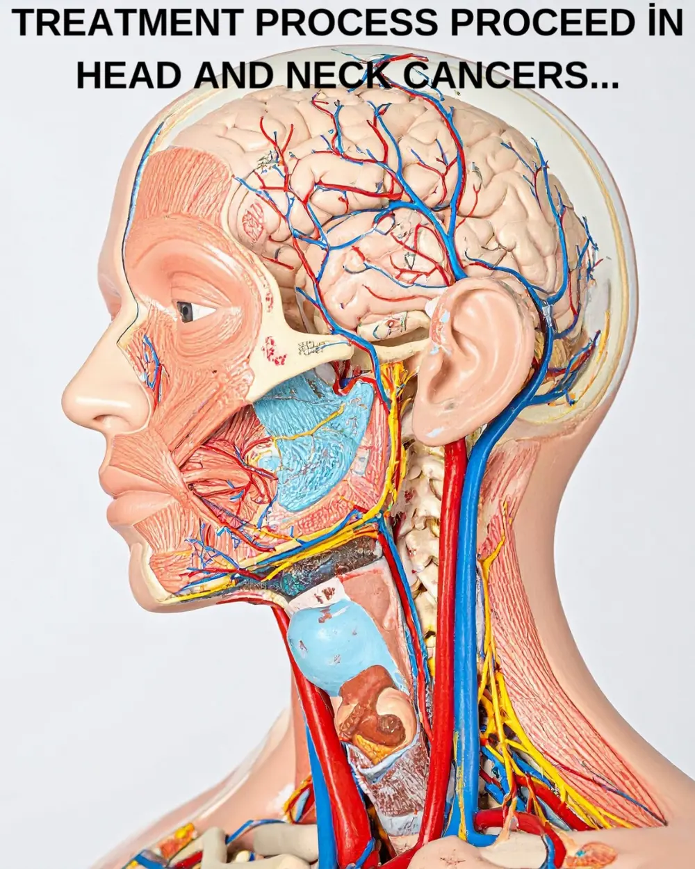 Anatomical model of the head and neck — still from the practice's video on head and neck cancer treatment