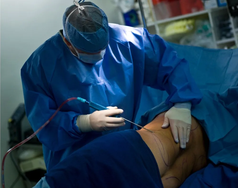 Thyroid surgery photograph