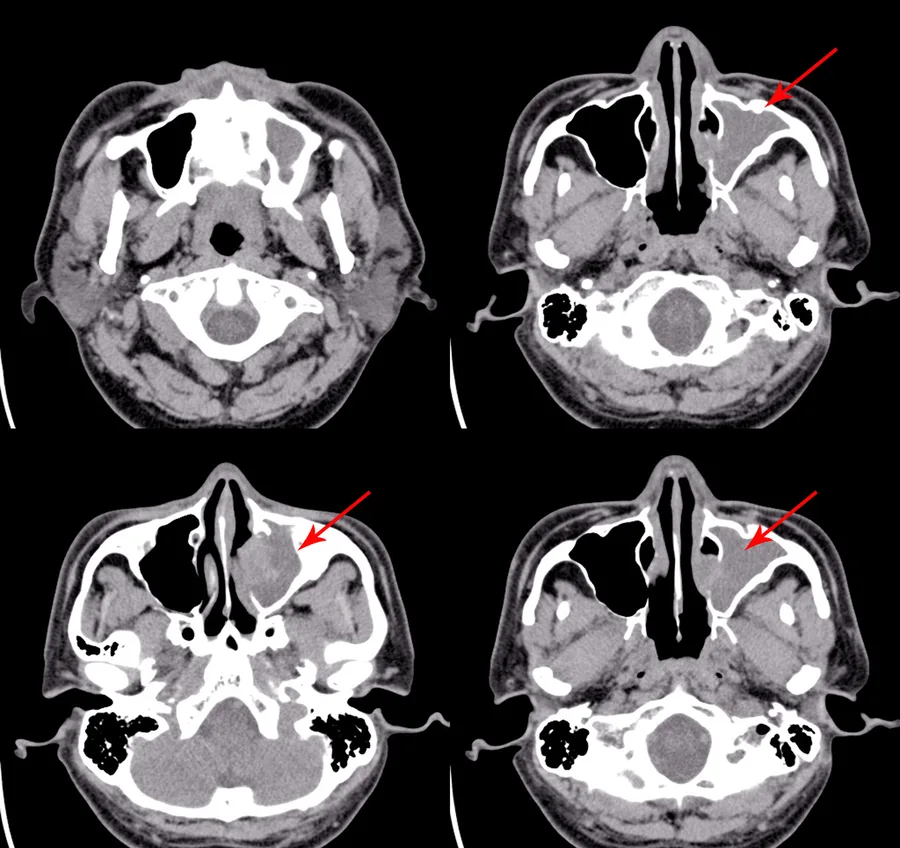 Skull X-ray imagery (stock image)